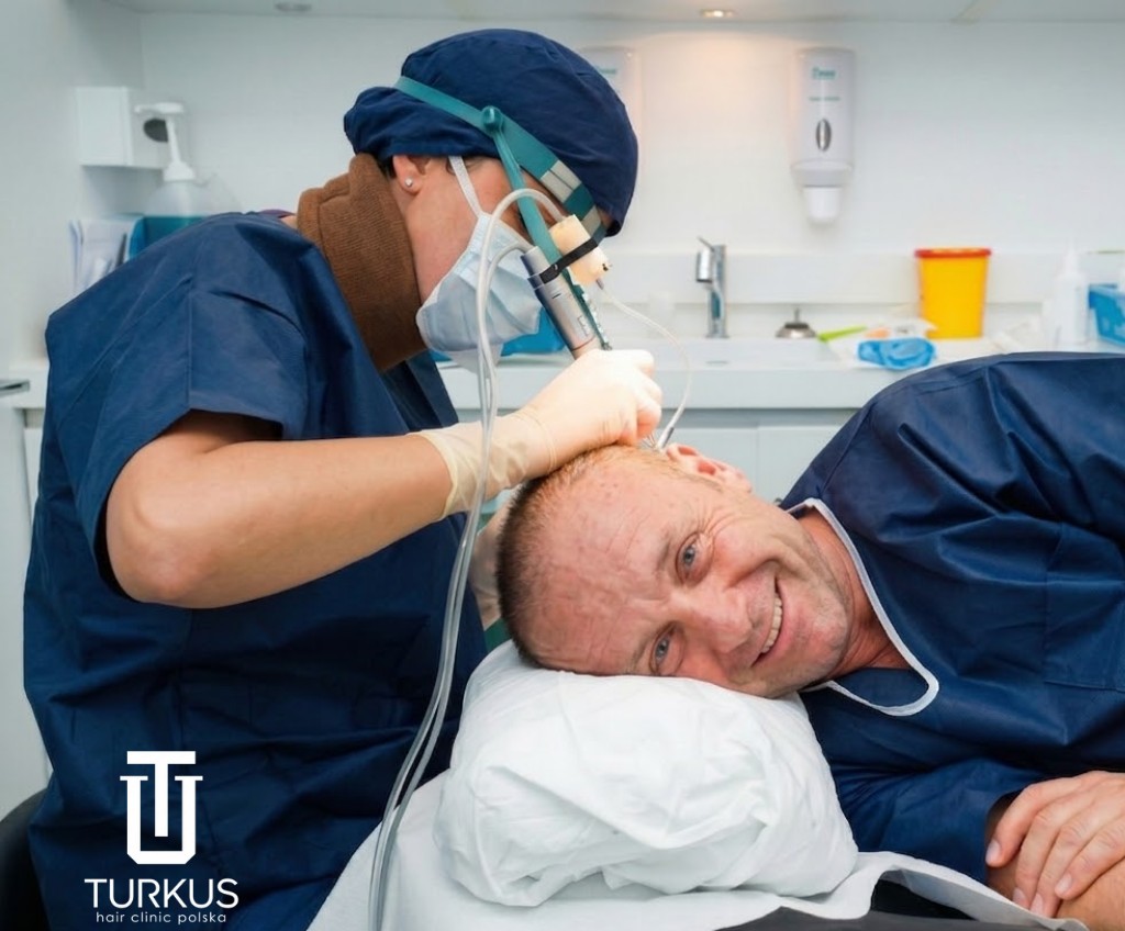 Zabieg FUE w toku: specjalista z lupą pracuje przy skórze głowy uśmiechniętego pacjenta w Turkus Hair Transplant Clinic.